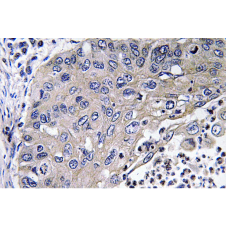 Immunohistochemistry - Anti-Cathepsin D Antibody (R12-2059) - Antibodies.com