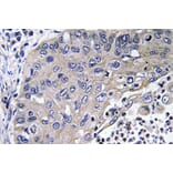 Immunohistochemistry - Anti-Cathepsin D Antibody (R12-2059) - Antibodies.com