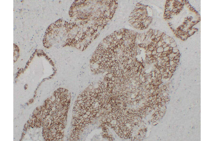 Immunohistochemistry - Anti-Cadherin 16 Antibody (V0089) - Antibodies.com