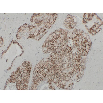 Immunohistochemistry - Anti-Cadherin 16 Antibody (V0089) - Antibodies.com