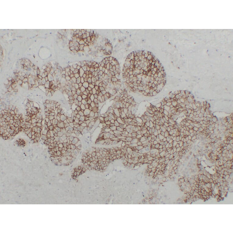 Immunohistochemistry - Anti-Cadherin 16 Antibody (V0089) - Antibodies.com