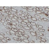 Immunohistochemistry - Anti-Cadherin 16 Antibody (V0089) - Antibodies.com