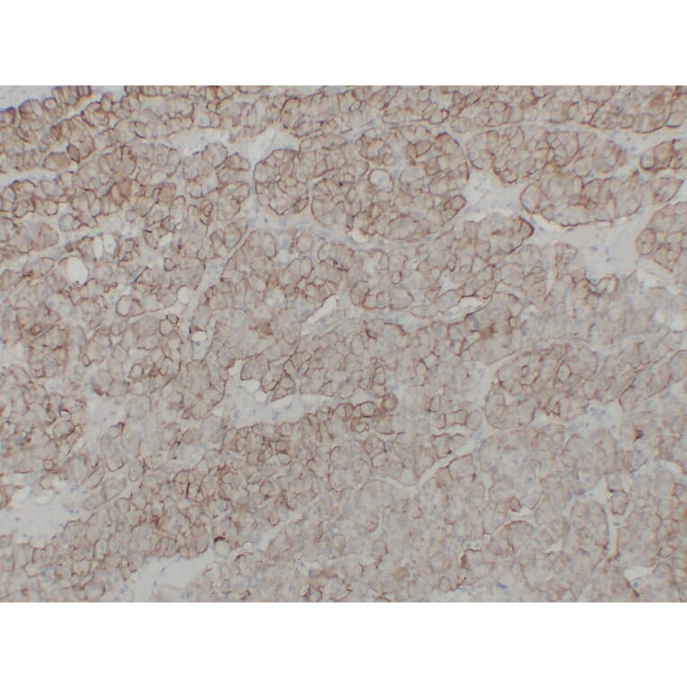 Immunohistochemistry - Anti-Cadherin 16 Antibody (V0089) - Antibodies.com