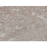 Immunohistochemistry - Anti-Cadherin 16 Antibody (V0089) - Antibodies.com