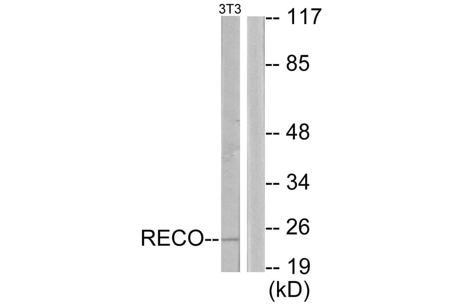 Western Blot - Anti-Recoverin Antibody (C10549) - Antibodies.com