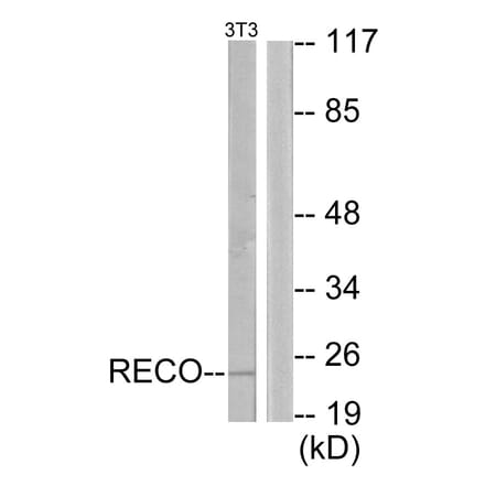 Western Blot - Anti-Recoverin Antibody (C10549) - Antibodies.com