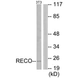 Western Blot - Anti-Recoverin Antibody (C10549) - Antibodies.com
