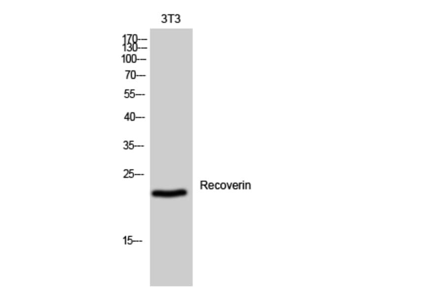 Western Blot - Anti-Recoverin Antibody (C10549) - Antibodies.com