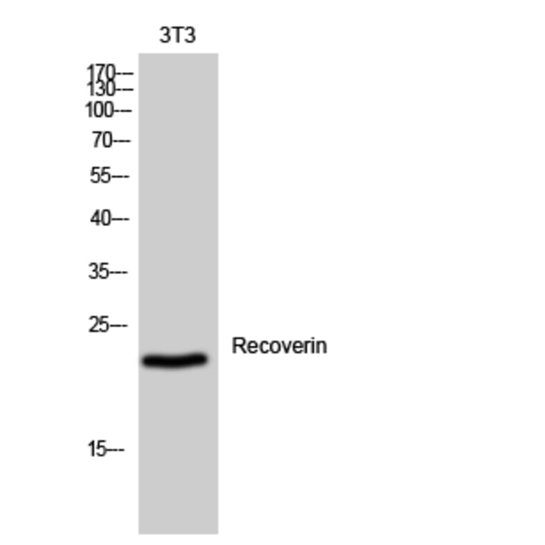Western Blot - Anti-Recoverin Antibody (C10549) - Antibodies.com