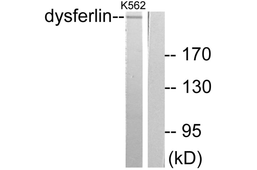 Western Blot - Anti-Dysferlin Antibody (C0176) - Antibodies.com