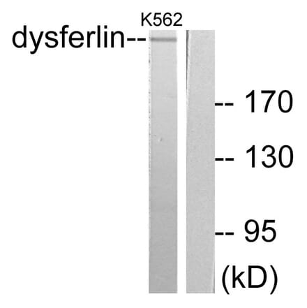 Western Blot - Anti-Dysferlin Antibody (C0176) - Antibodies.com