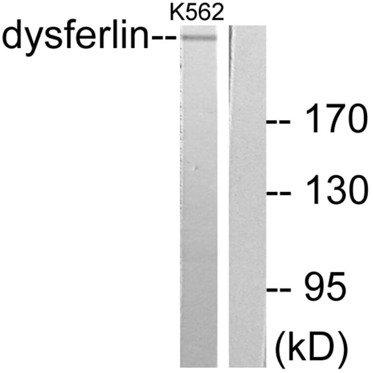 Western Blot - Anti-Dysferlin Antibody (C0176) - Antibodies.com