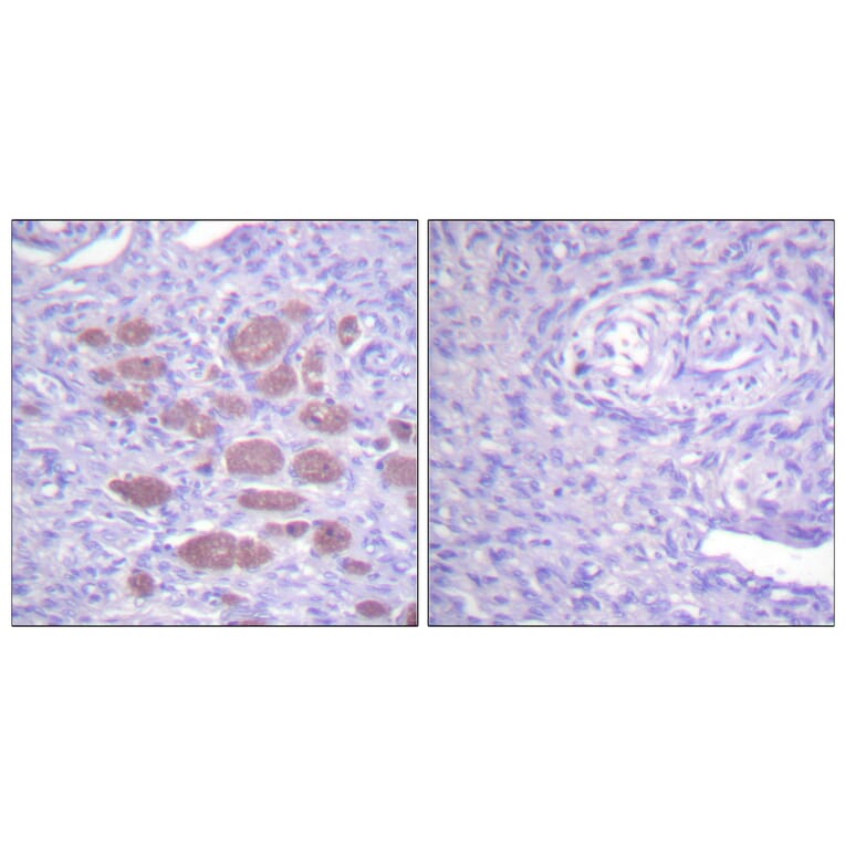 Immunohistochemistry - Anti-p40 phox Antibody (B0697) - Antibodies.com