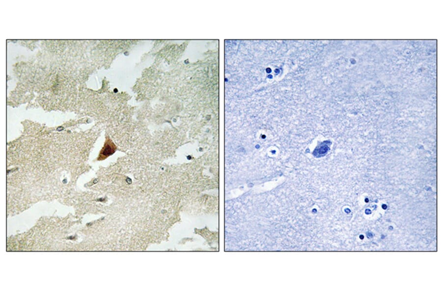 Immunohistochemistry - Anti-MAPKAPK5 Antibody (C11312) - Antibodies.com