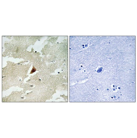 Immunohistochemistry - Anti-MAPKAPK5 Antibody (C11312) - Antibodies.com