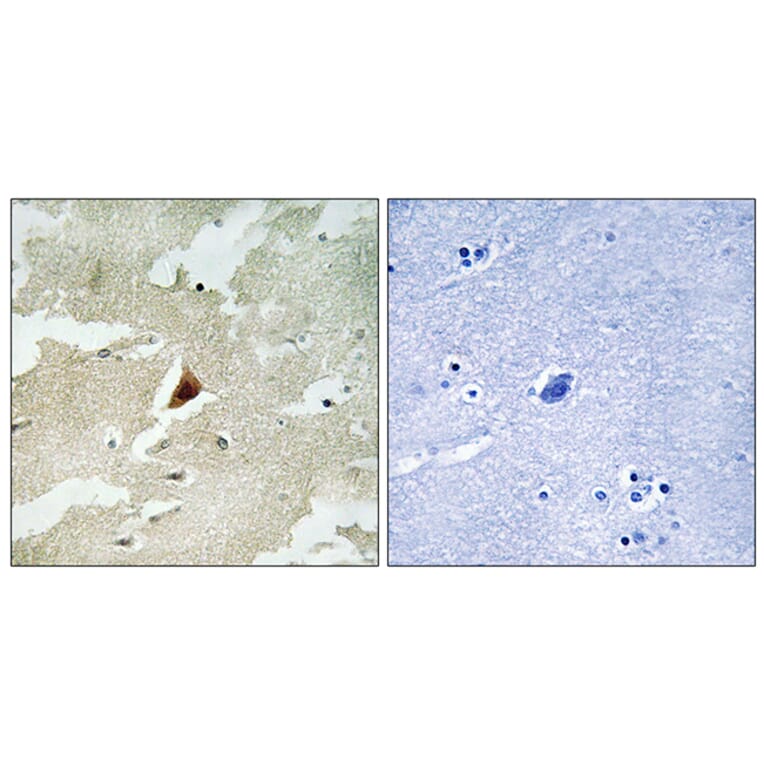 Immunohistochemistry - Anti-MAPKAPK5 Antibody (C11312) - Antibodies.com