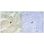 Immunohistochemistry - Anti-MAPKAPK5 Antibody (C11312) - Antibodies.com