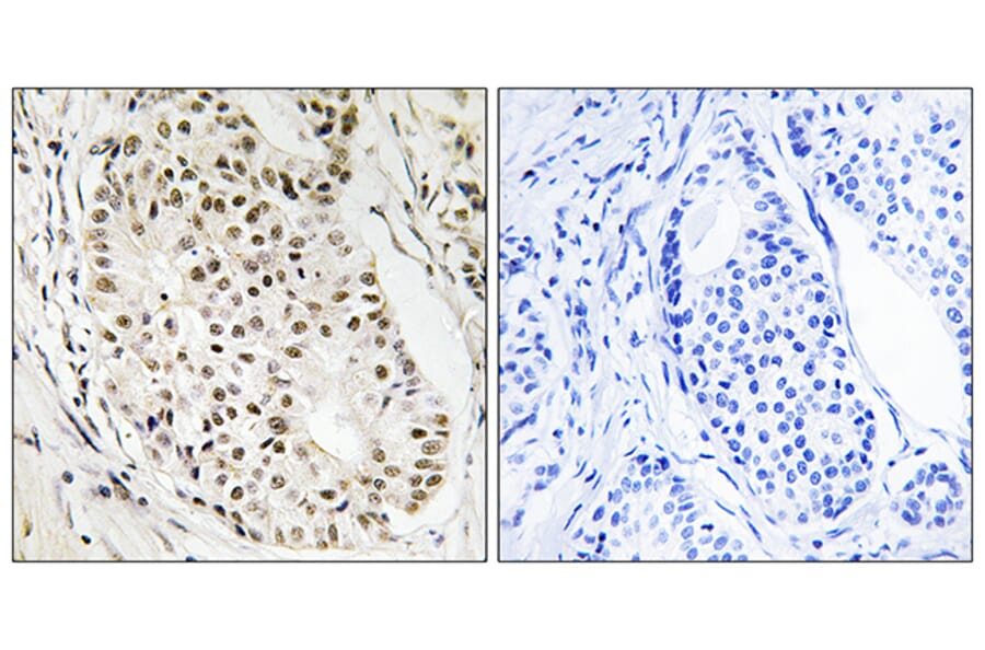 Immunohistochemistry - Anti-HNRNPUL2 Antibody (C16125) - Antibodies.com