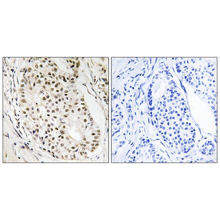 Immunohistochemistry - Anti-HNRNPUL2 Antibody (C16125) - Antibodies.com