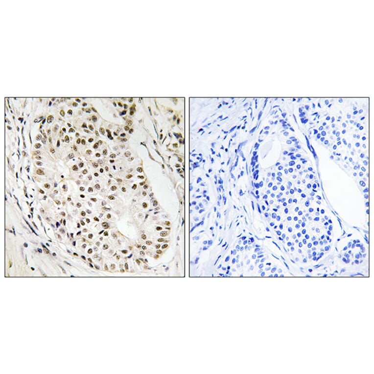 Immunohistochemistry - Anti-HNRNPUL2 Antibody (C16125) - Antibodies.com