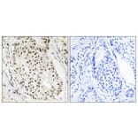 Immunohistochemistry - Anti-HNRNPUL2 Antibody (C16125) - Antibodies.com