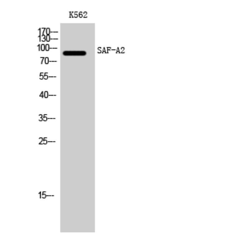 Western Blot - Anti-HNRNPUL2 Antibody (C16125) - Antibodies.com