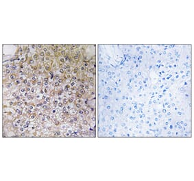 Immunohistochemistry - Anti-ATP6V1B1 Antibody (C19470) - Antibodies.com