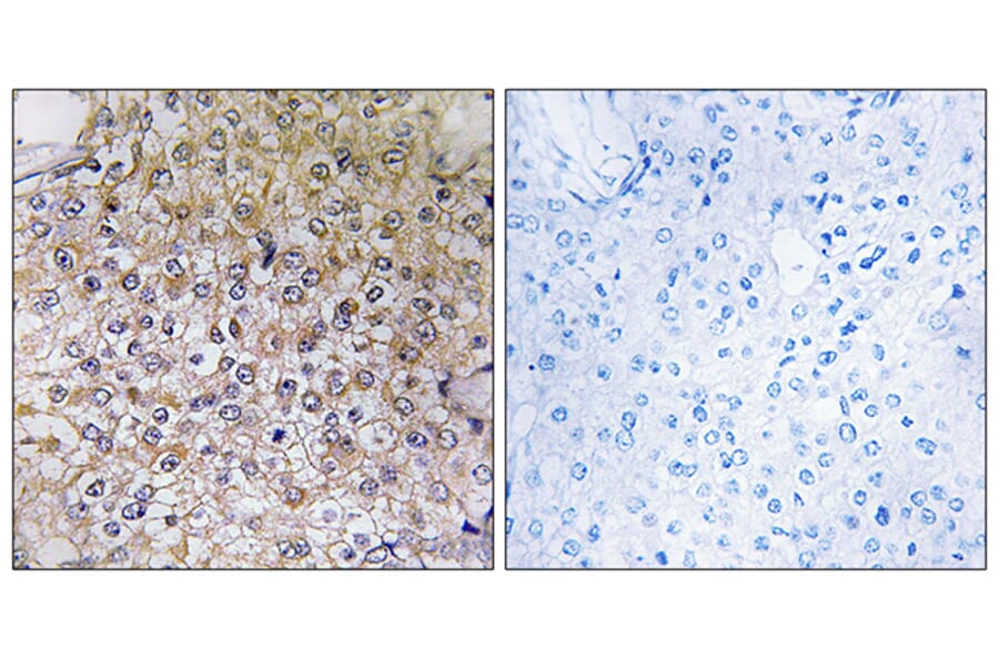 Immunohistochemistry - Anti-ATP6V1B1 Antibody (C19470) - Antibodies.com