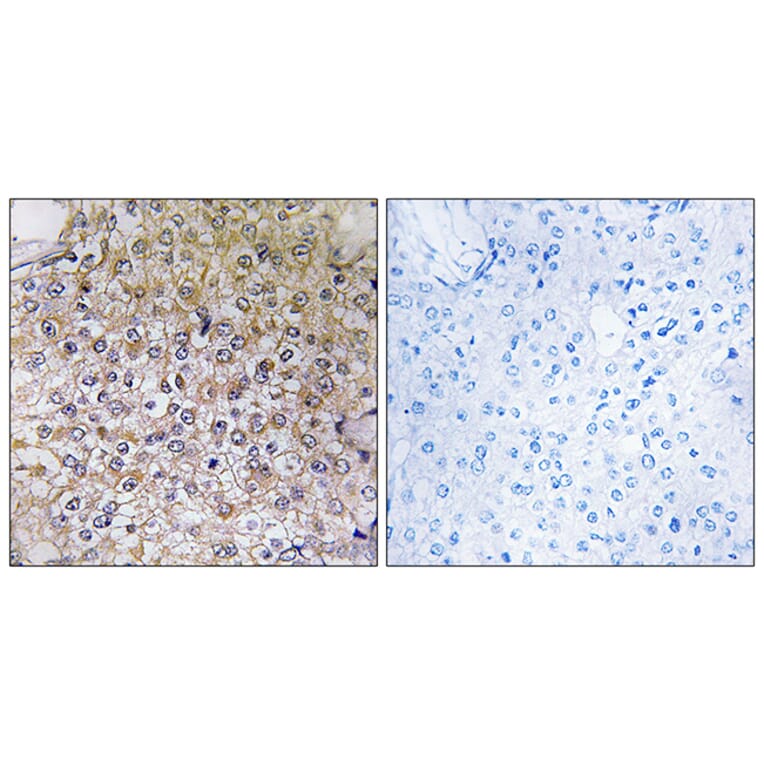 Immunohistochemistry - Anti-ATP6V1B1 Antibody (C19470) - Antibodies.com