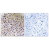 Immunohistochemistry - Anti-ATP6V1B1 Antibody (C19470) - Antibodies.com