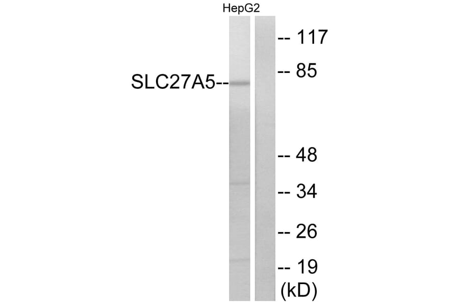 Western Blot - Anti-SLC27A5 Antibody (C14745) - Antibodies.com