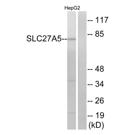 Western Blot - Anti-SLC27A5 Antibody (C14745) - Antibodies.com