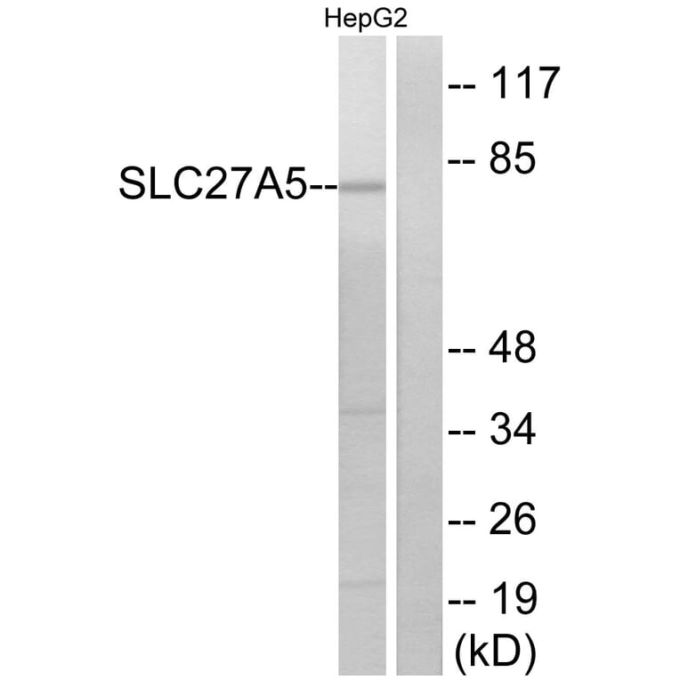 Western Blot - Anti-SLC27A5 Antibody (C14745) - Antibodies.com