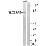 Western Blot - Anti-SLC27A5 Antibody (C14745) - Antibodies.com