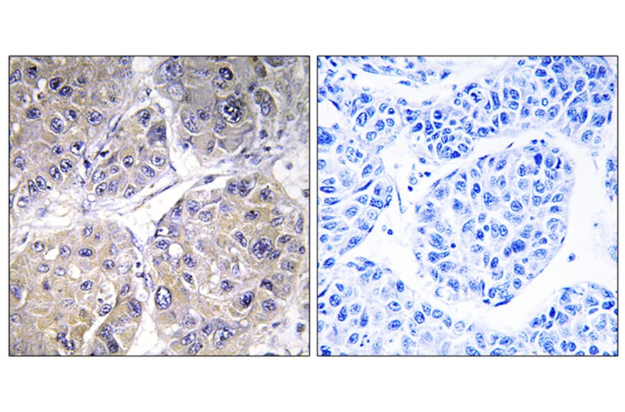Immunohistochemistry - Anti-SLC27A5 Antibody (C14745) - Antibodies.com