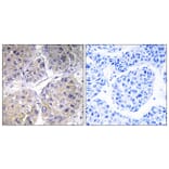 Immunohistochemistry - Anti-SLC27A5 Antibody (C14745) - Antibodies.com