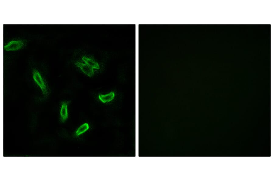 Immunofluorescence - Anti-SLC27A5 Antibody (C14745) - Antibodies.com