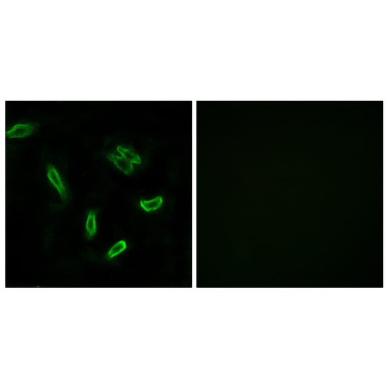 Immunofluorescence - Anti-SLC27A5 Antibody (C14745) - Antibodies.com