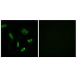 Immunofluorescence - Anti-SLC27A5 Antibody (C14745) - Antibodies.com