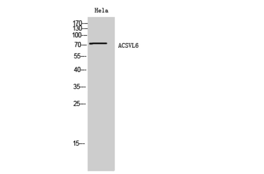 Western Blot - Anti-SLC27A5 Antibody (C14745) - Antibodies.com