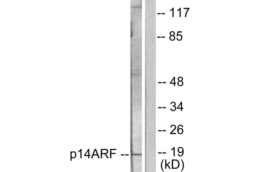 Western Blot - Anti-p14 ARF Antibody (C0286) - Antibodies.com