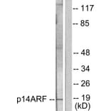 Western Blot - Anti-p14 ARF Antibody (C0286) - Antibodies.com