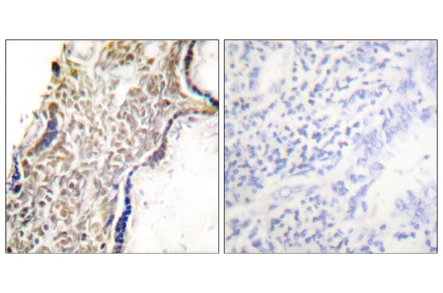 Immunohistochemistry - Anti-p14 ARF Antibody (C0286) - Antibodies.com
