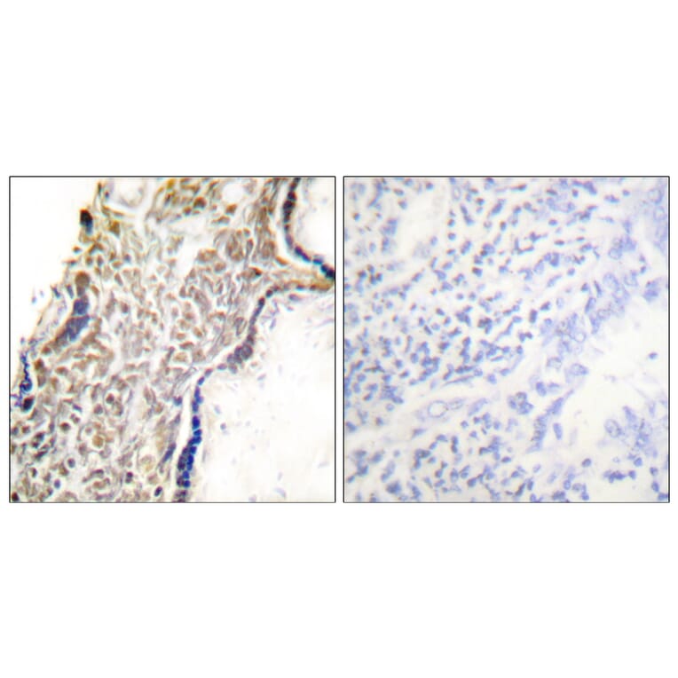 Immunohistochemistry - Anti-p14 ARF Antibody (C0286) - Antibodies.com