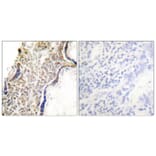 Immunohistochemistry - Anti-p14 ARF Antibody (C0286) - Antibodies.com