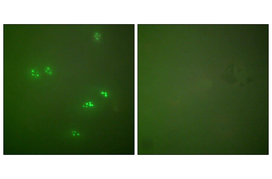 Immunofluorescence - Anti-p14 ARF Antibody (C0286) - Antibodies.com