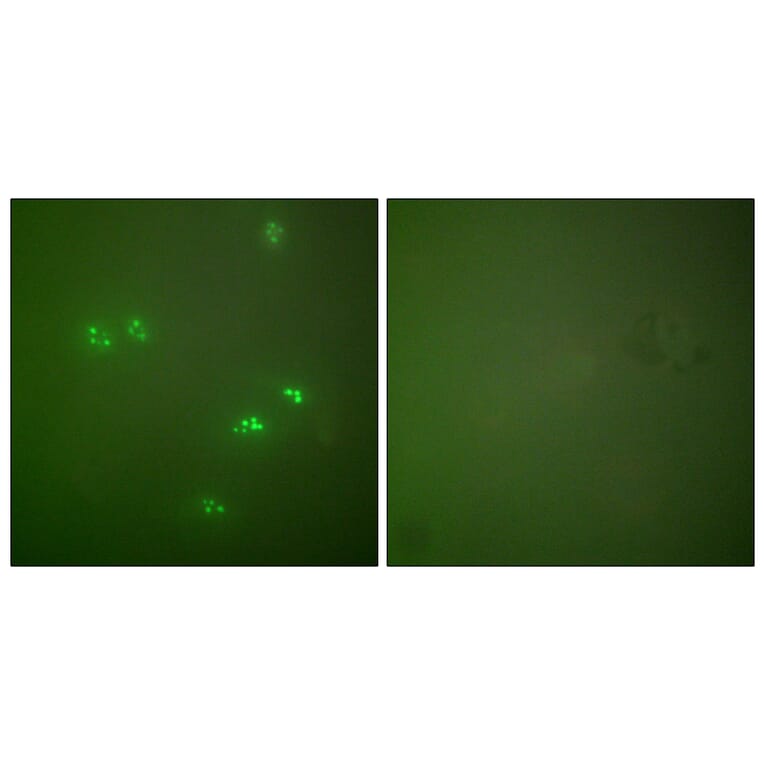 Immunofluorescence - Anti-p14 ARF Antibody (C0286) - Antibodies.com