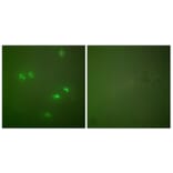 Immunofluorescence - Anti-p14 ARF Antibody (C0286) - Antibodies.com