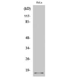 Western Blot - Anti-p14 ARF Antibody (C0286) - Antibodies.com