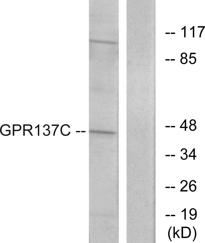 Western blot analysis of lysates from HepG2 cells using Anti-GPR137C Antibody. The right hand lane represents a negative control, where the antibody is blocked by the immunising peptide.
